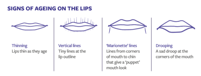 Signs of lip aging