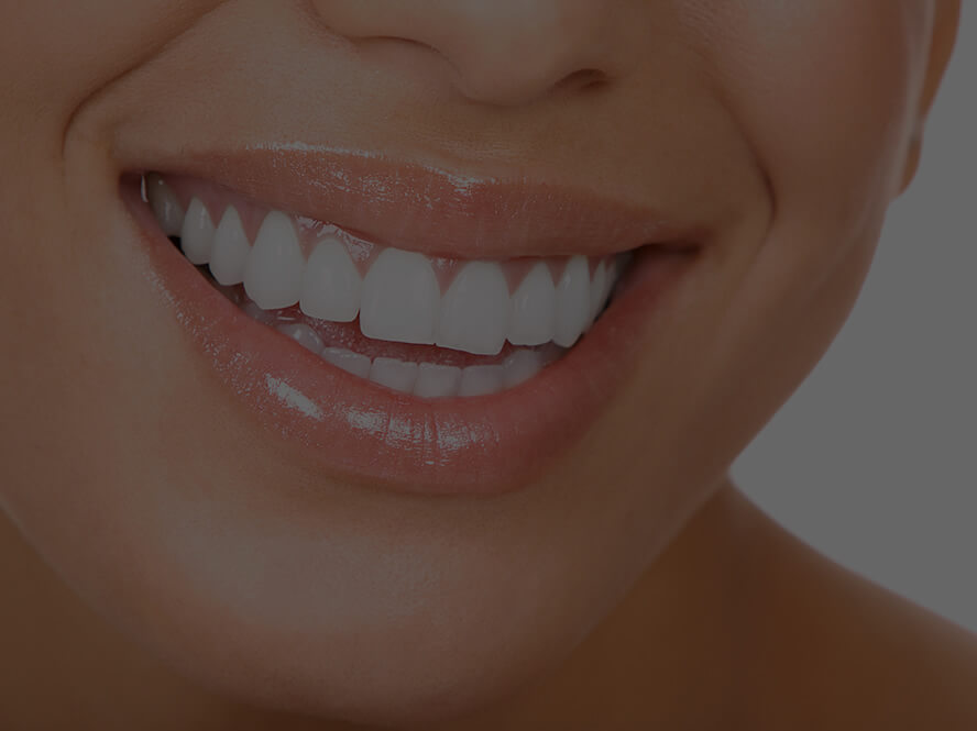 dental hygienist near me in Surrey